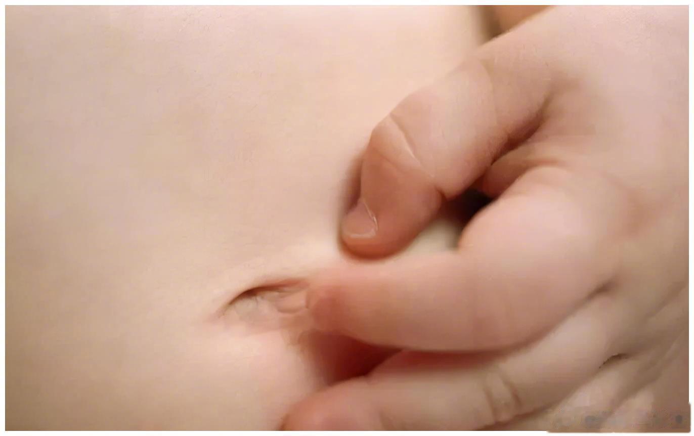 #为什么不能抠肚脐眼# 孩子的肚脐脏了，能不能抠？▶肚脐其实就是一个“疤痕”对于