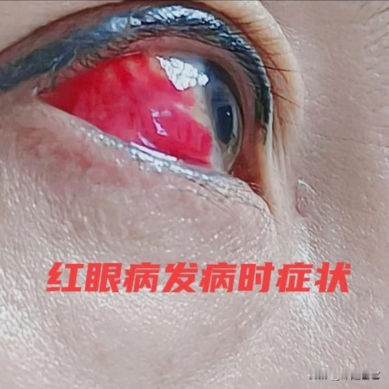 狗权和人权？
狗一直是被绳索捆绑着生活的，没有那一条狗可以光明正大的去逛公园，去