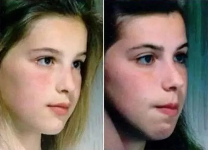 【#呼吸方式也会影响颜值#  你是口呼吸还是鼻呼吸？】作为人体正常呼吸主导模式，