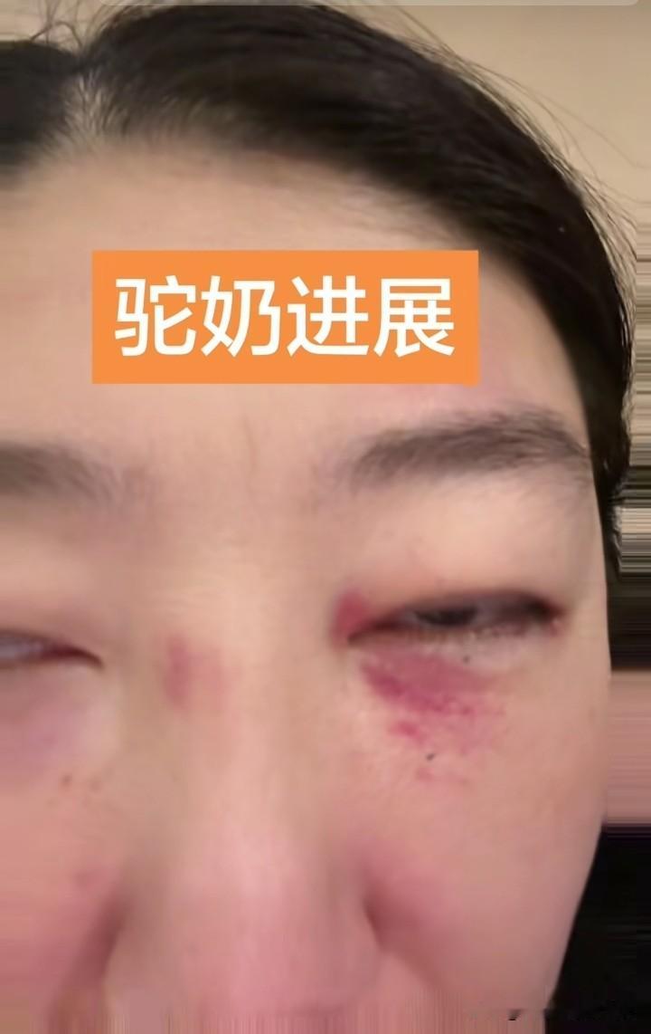 李雨禅在白良村被打了！这事听上去很荒诞，其实一点儿都不意外。
就在这种状态下她依
