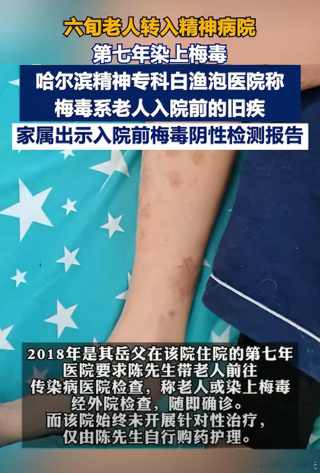 老人入住精神病院7年后患梅毒这也太夸张啦，要知道精神病院出现这种事，应该算大事故