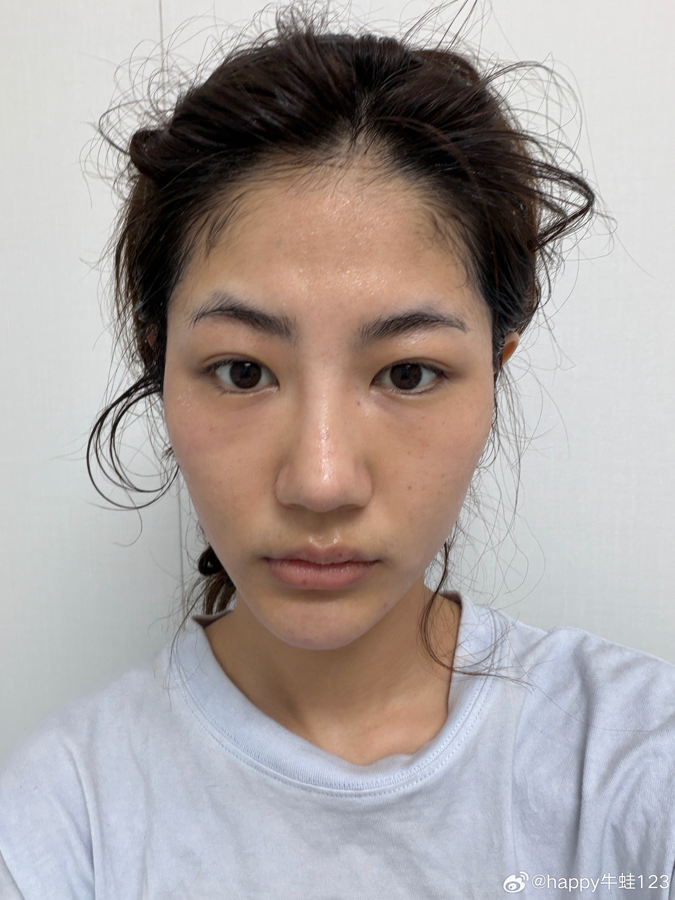 黄金微针➕大提升➕水光水光针是C罗送我的，前天买的5:0 