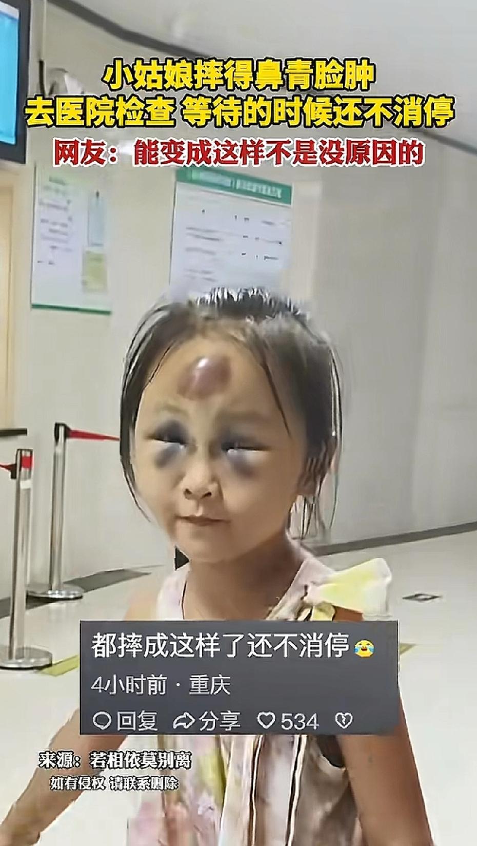 是该心疼她，还是该笑她？小女孩摔成“烟熏妆”还在蹦，妈妈反应更绝……

家人们，