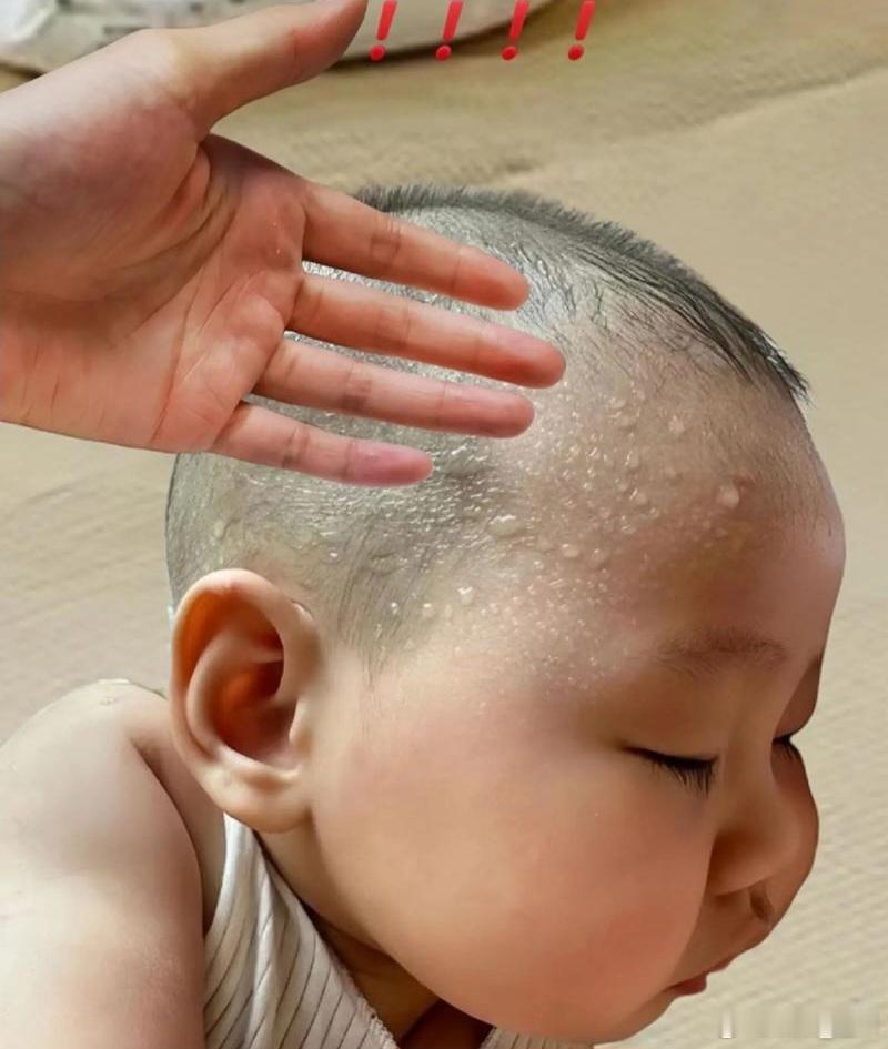 结合中医「炁（先天主功能）、氣（后天主形体）」核心逻辑，针对小儿“稚阴稚阳、肺脾