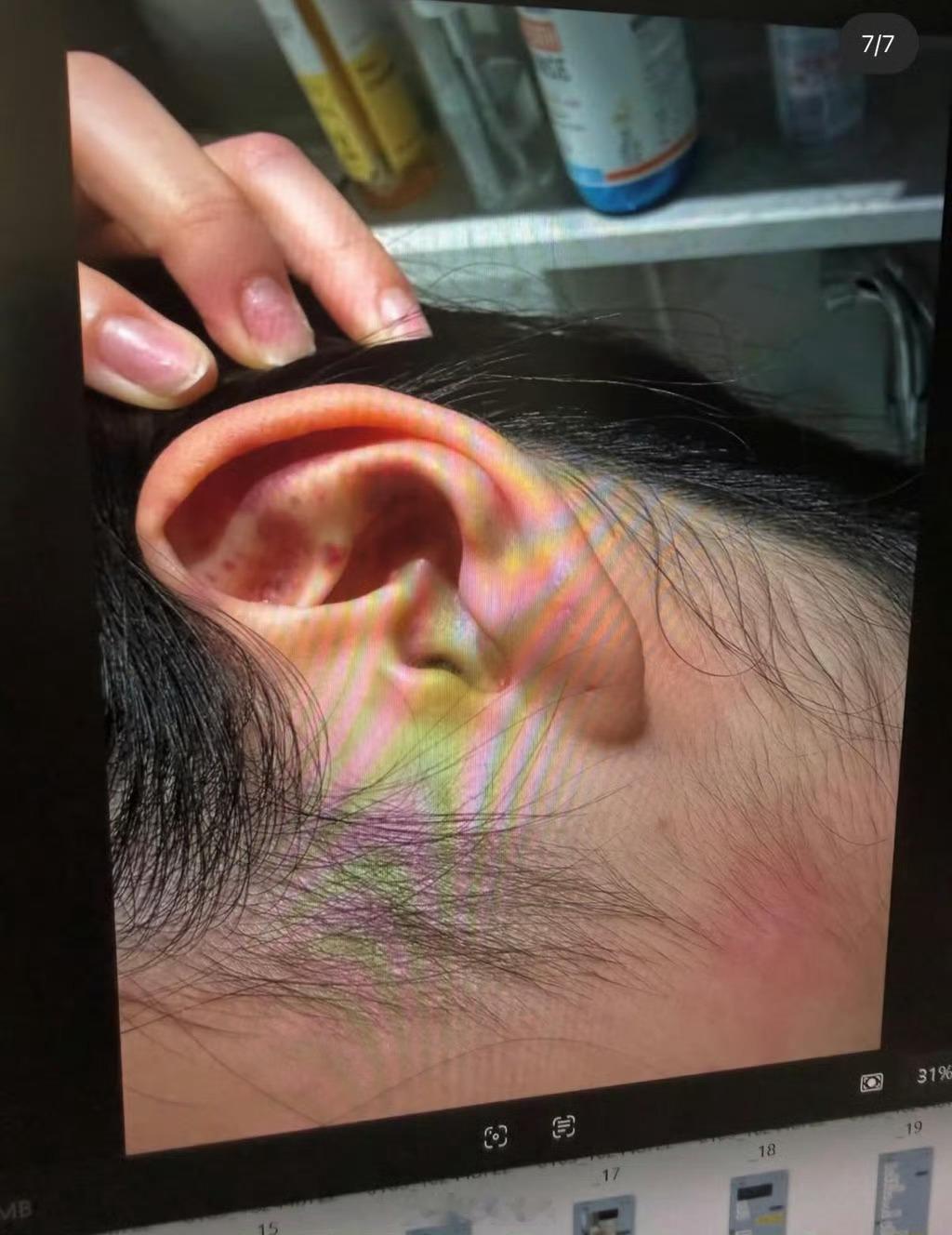 曝金智秀的哥哥家暴金智秀哥哥的妻子出来控诉他家暴自己…我的天啊看起来好严重