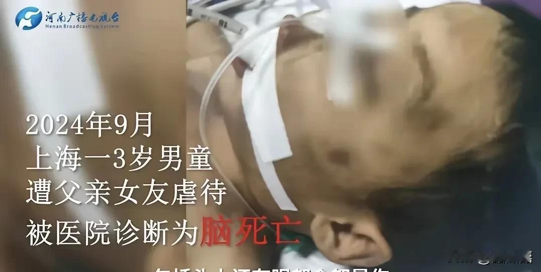 上海三岁男童遭长期虐待致死！生父欲放弃治疗，母亲悲痛报警揭露真相，生父女友被拘后