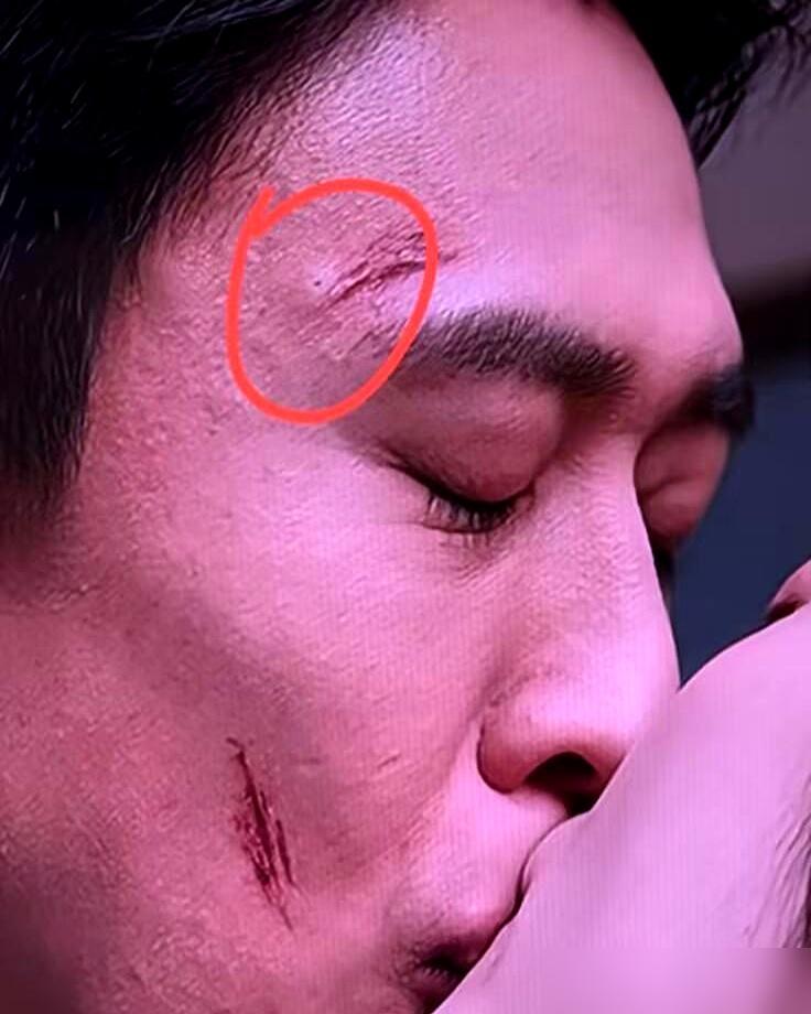 王天辰红着眼撞上去，郭晓婷下巴结结实实挨了一下。一场吻戏，硬是啃出牛耕地的架势。