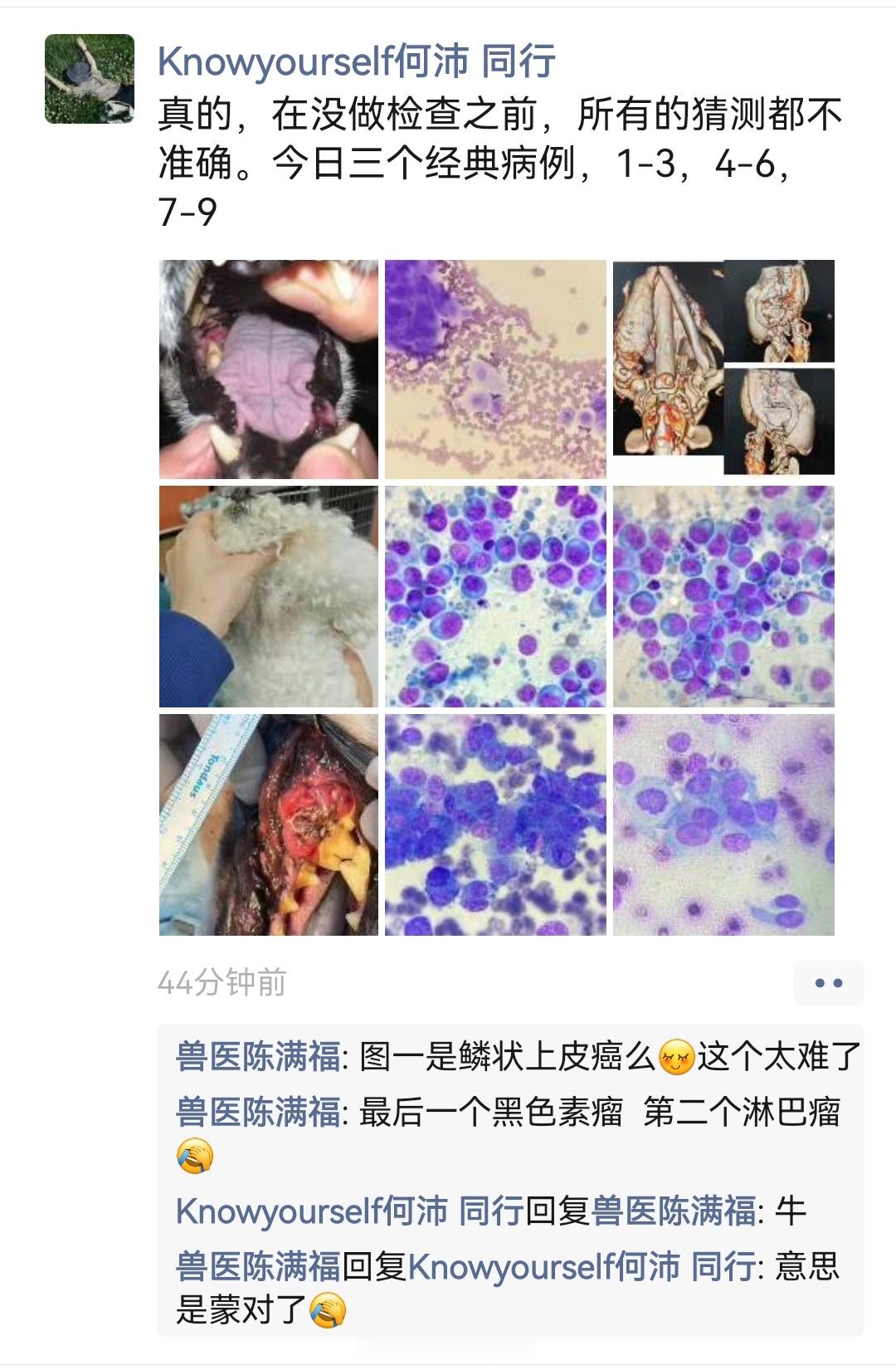 一个同行分享的细胞学知识。鳞状细胞瘤，淋巴癌，黑色素瘤。  