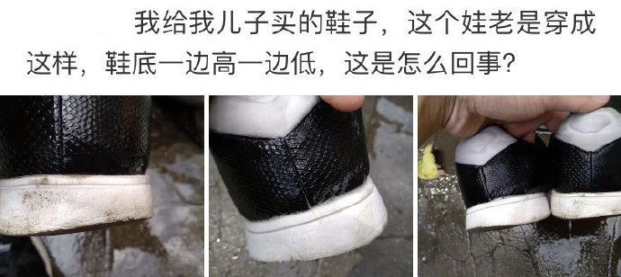 孩子穿这样的鞋子正常吗 ​​​