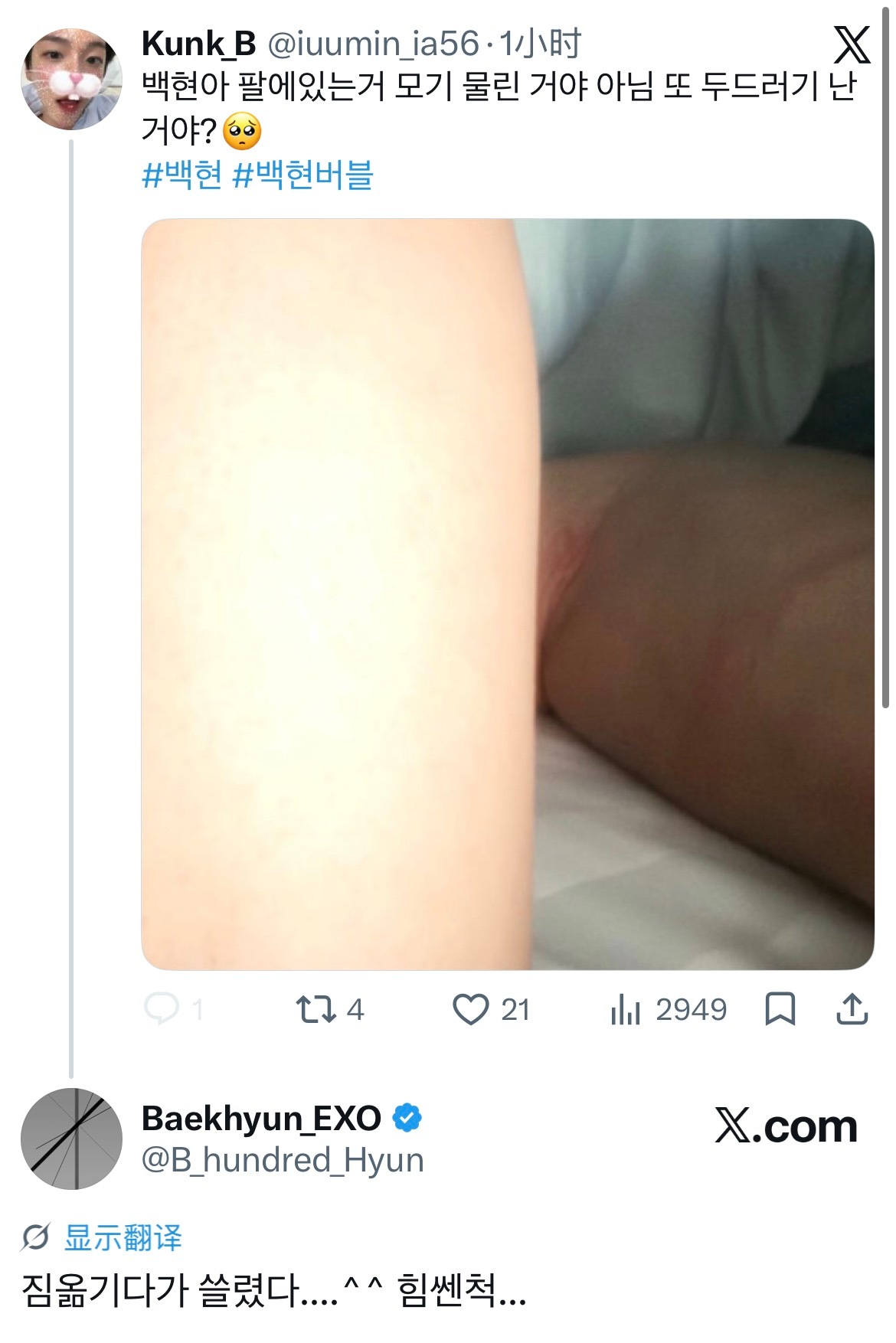 边伯贤 ❤️：伯贤啊 你手臂上的那个是被蚊子咬的吗？还是又起荨麻疹了？🥺🐶：