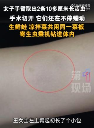 广东，一女子一年前手臂上莫名其妙长了包块，起初也没太当回事，结果最近因为包块痛得