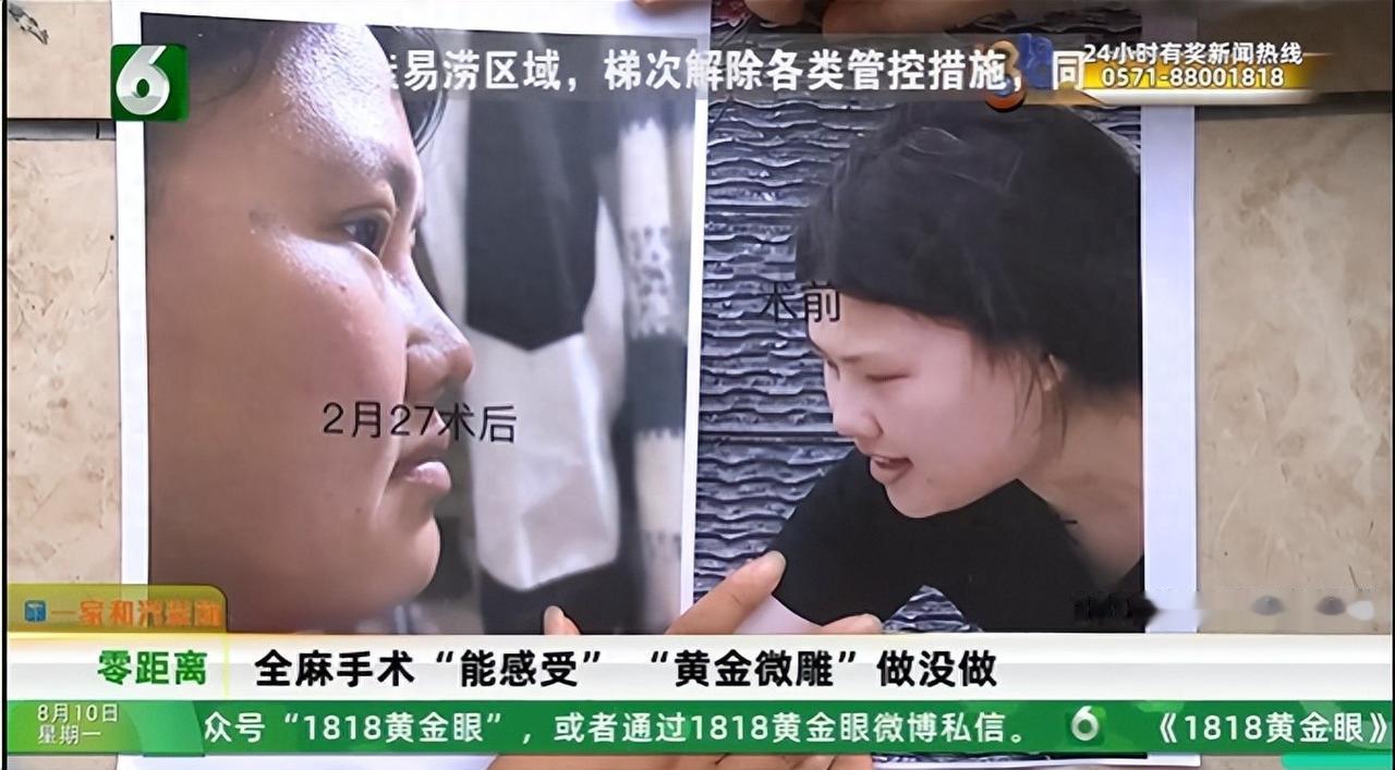 浙江女子称花四万多医美却缺失重要项目，病例数据也不对，因出不起鉴定费要求院方垫付