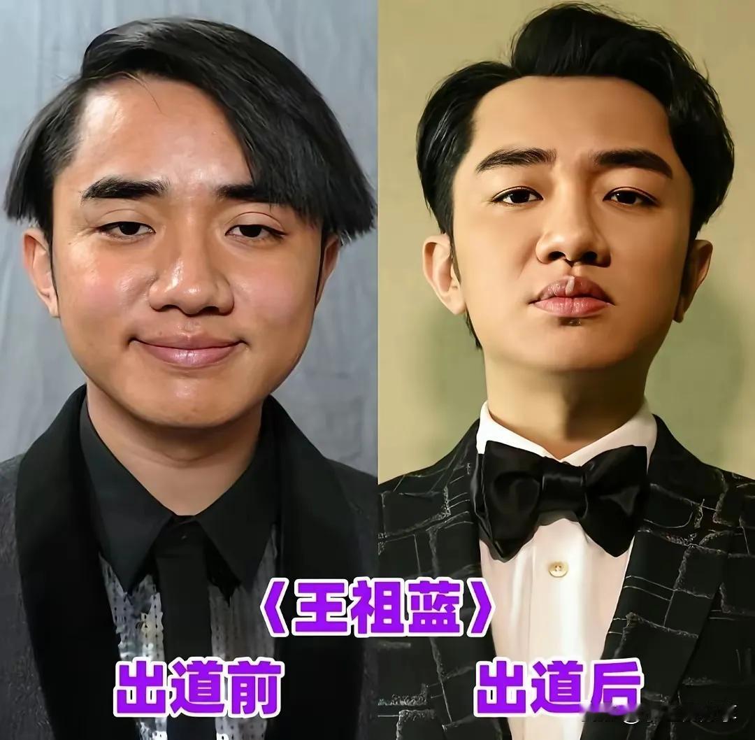 出道后颜值和气质提升很多—王祖蓝
出道后颜值和气质提升很多—张嘉译
出道后颜值和