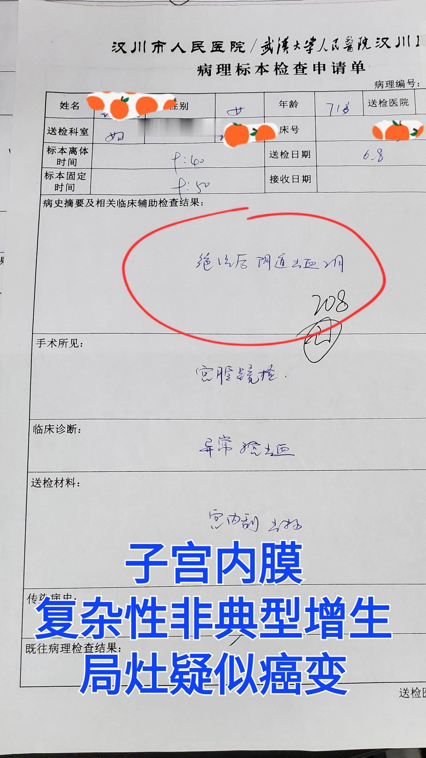局灶疑似癌变
