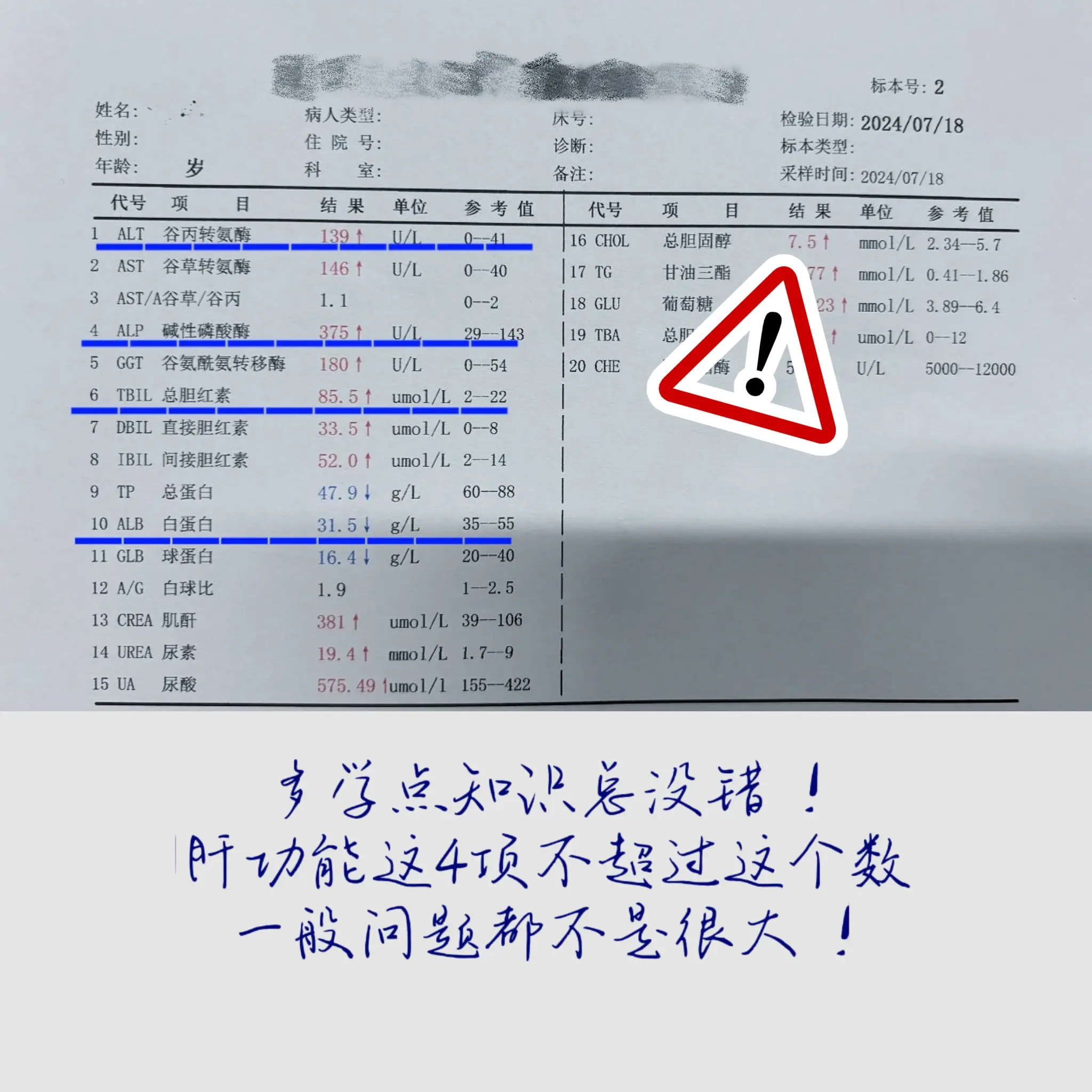 1、转氨酶不超过80！ 2、GGT不超过50！ 3、总胆红素不超过22...