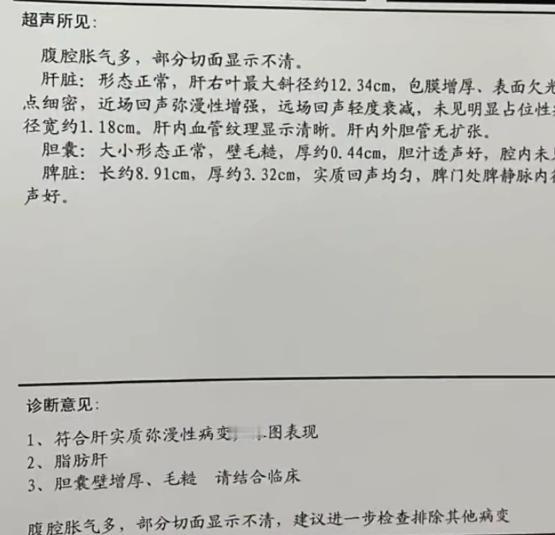 肝脏彩超一旦出现这5点警惕肝硬化！
注意了！肝脏彩超也可以发现肝硬化，很多肝病患