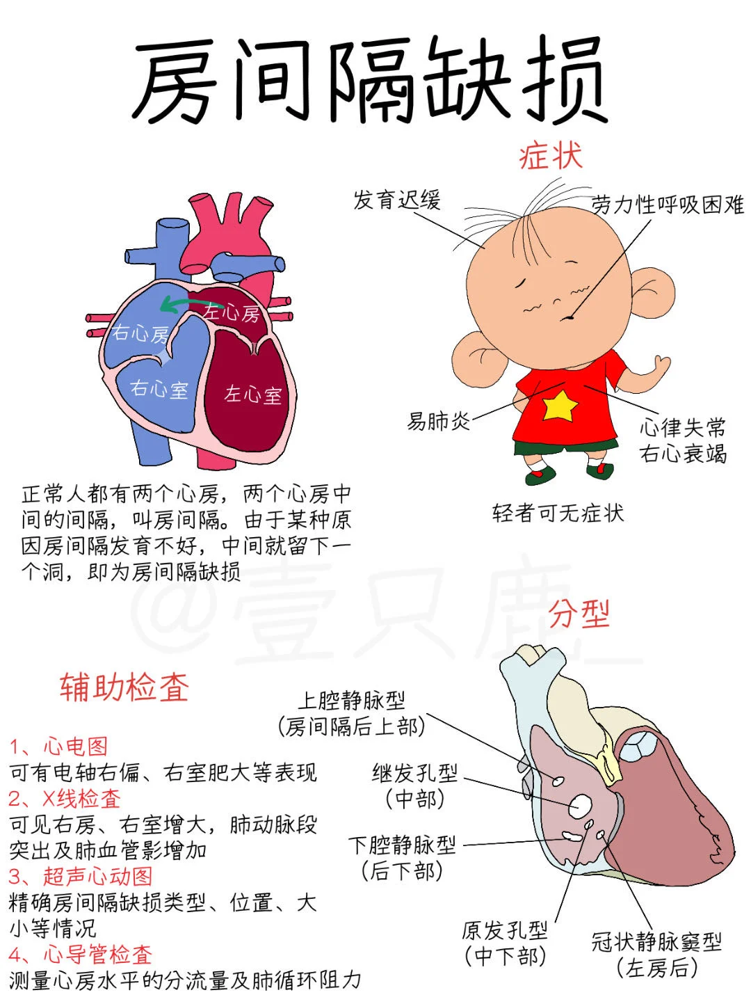 医学生笔记📝｜房间隔缺损