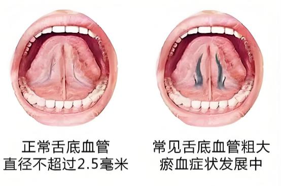 今日舌诊挑战！

今天又是坚持舌诊的一天，抽时间继续来帮大家免费辨证分析！

有