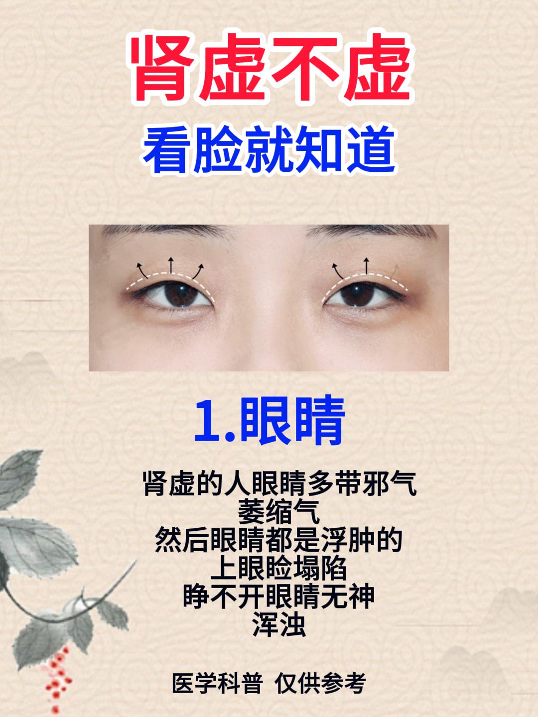 肾虚不虚，看脸就知道[谢谢][谢谢][谢谢]

1.眼睛无神
2.脸部松垮
3.