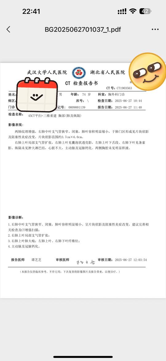 有没有会看ct的uu😭