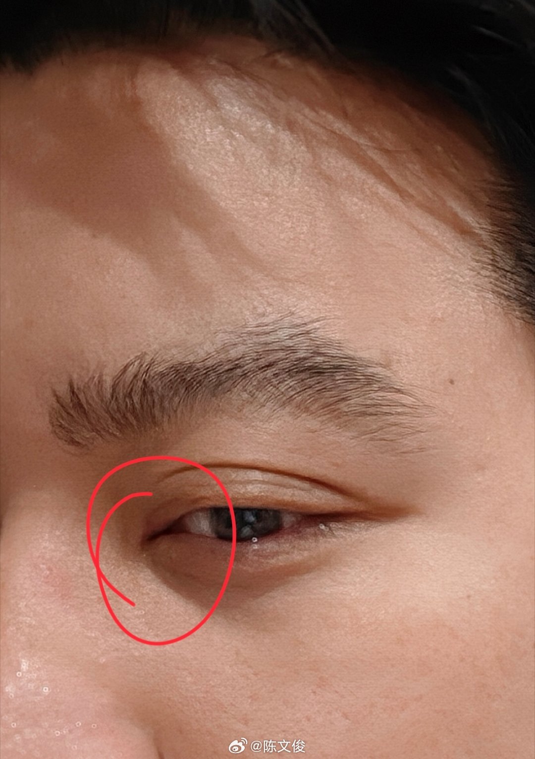 禄柒，生眼挑针！ 