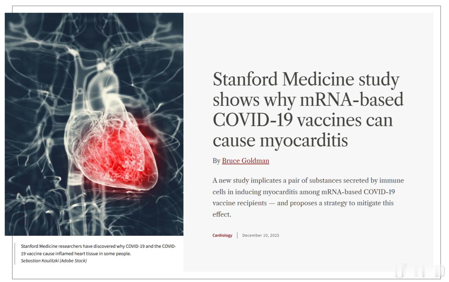 斯坦福大学医学院的一项研究揭示了基于mRNA的新冠疫苗为何会引发心肌炎。一场全人