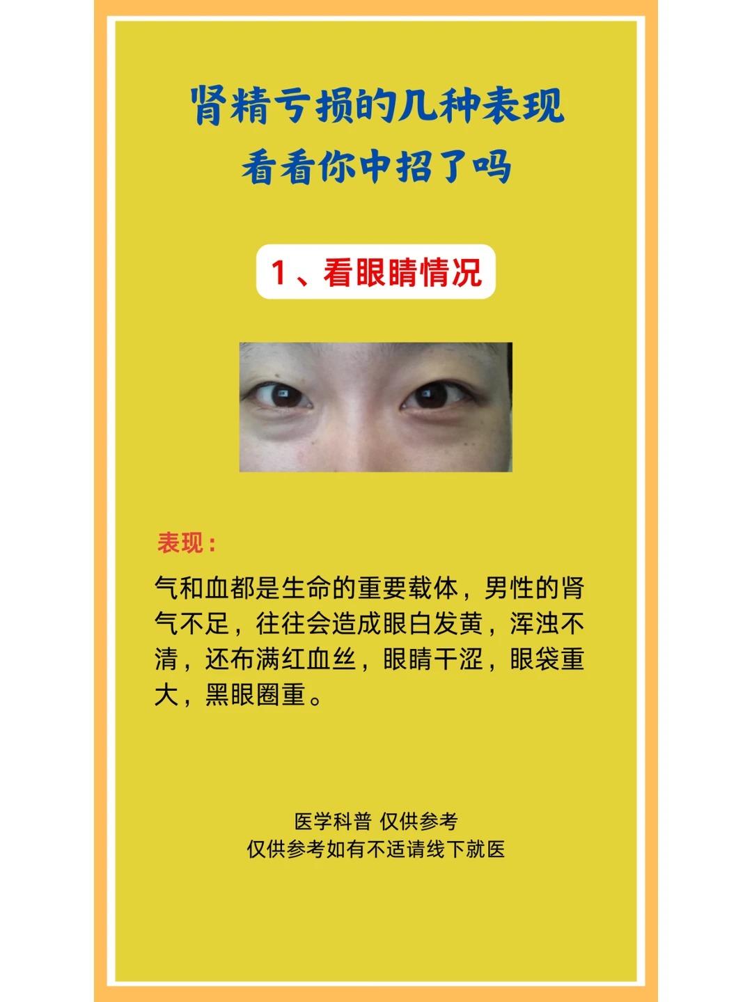 肾精亏损有哪些表现？快来对照看看