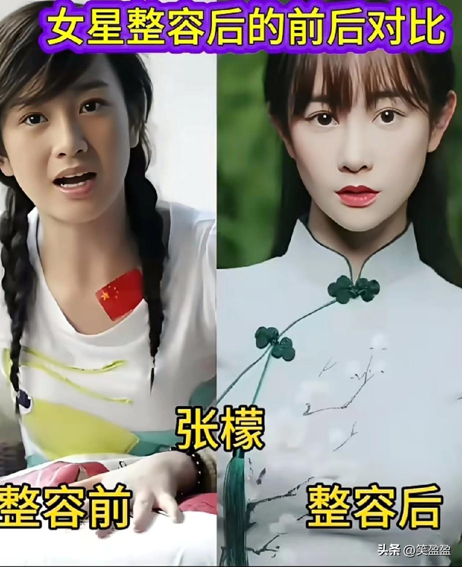 女明星整容后的前后对比
直接傻眼了
尤其最后一位
你觉得哪位最成功？