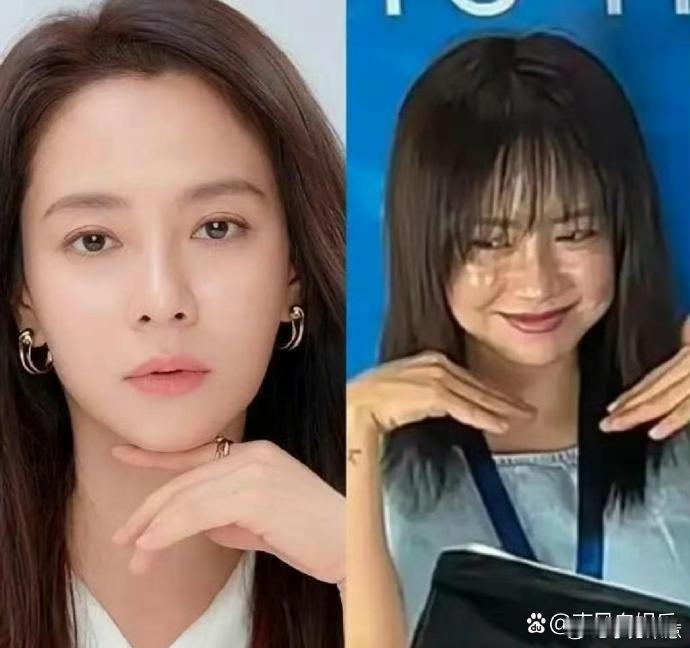 医美狠角色！600针美容针，美女也怕疼。 