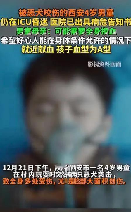 大快人心！12月21日，陕西省一4岁男童被狗咬后，生命一度垂危。然而，伤人的恶狗