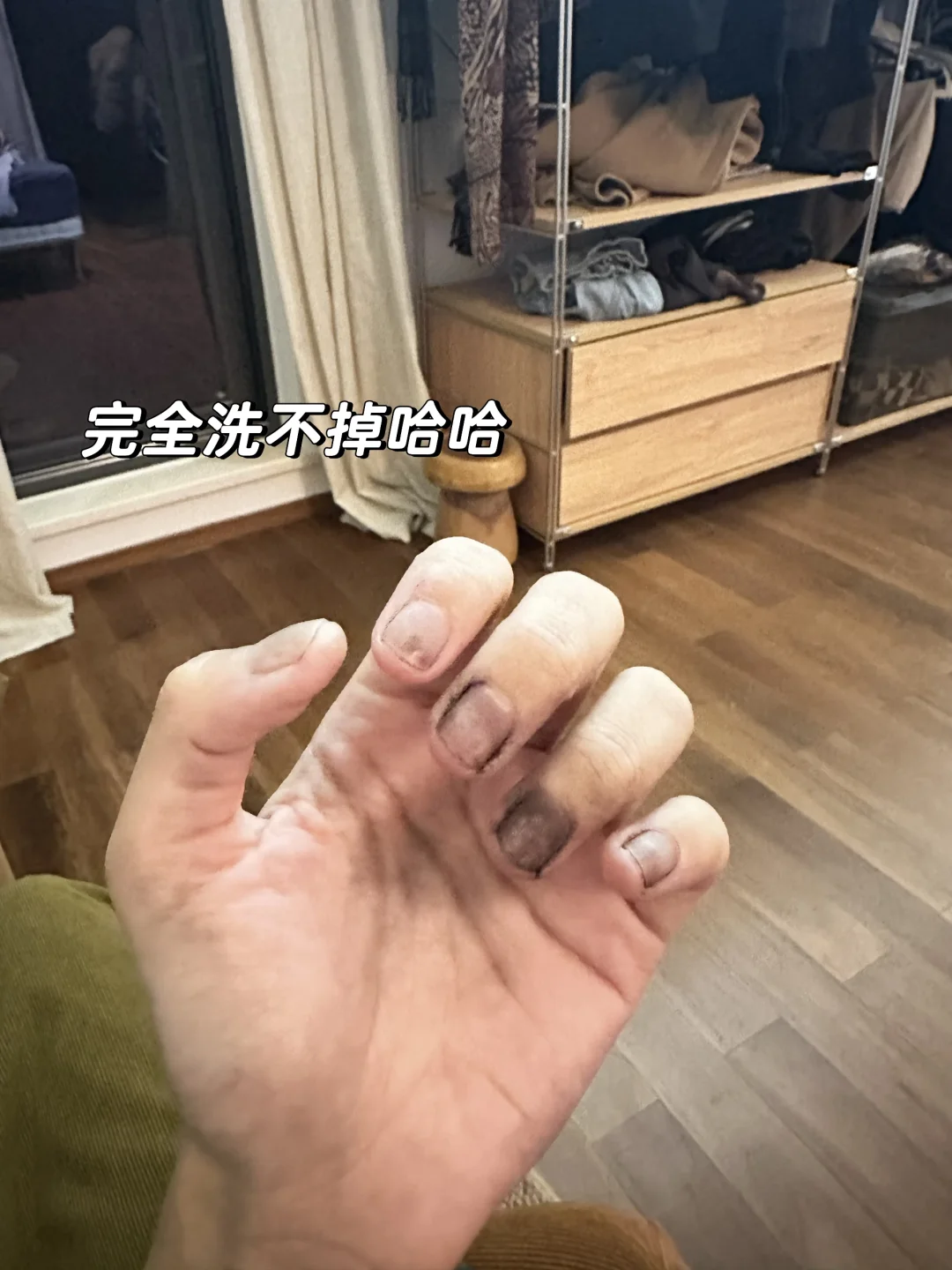 建议大家不要自己做黑色的美缝