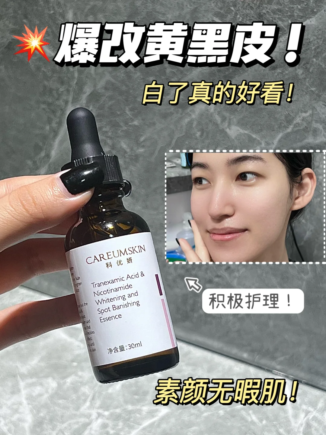黄黑皮爆改冷白皮的底气是它给的…