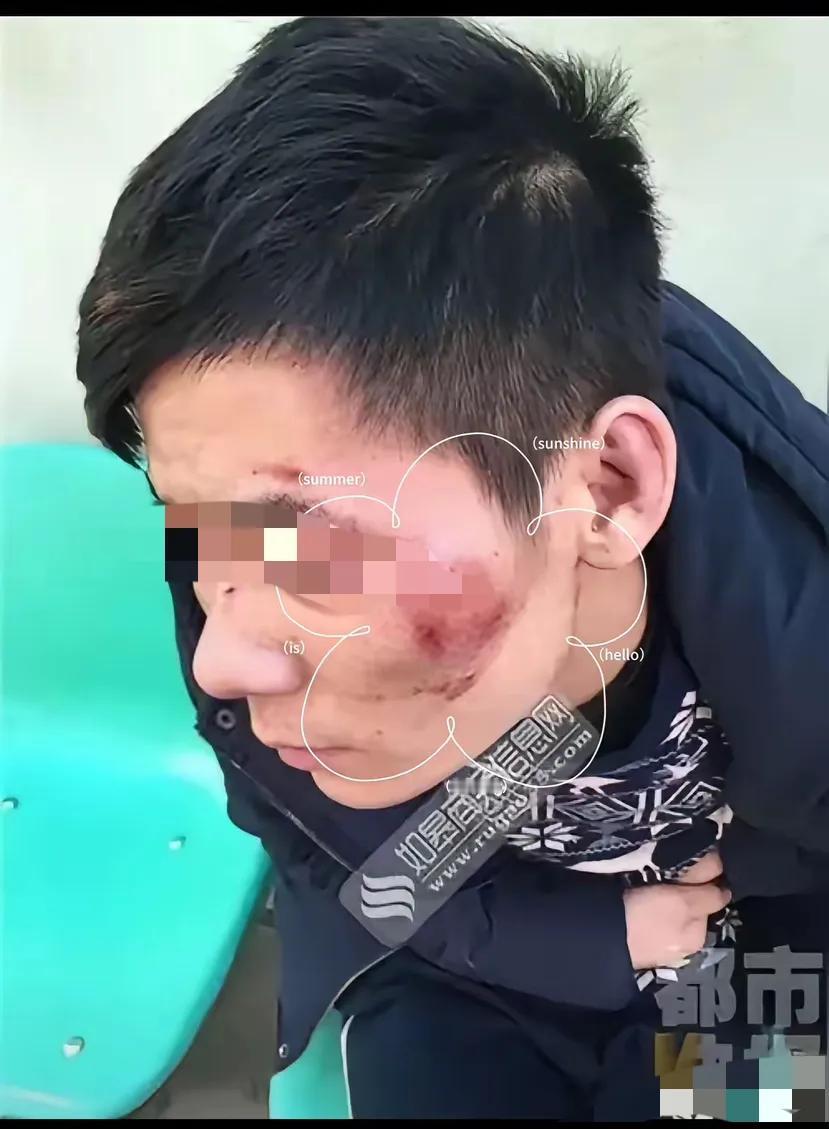 大半夜被追打，直奔武警营门[赞][赞]
这哥们儿把"绝境求生"玩明白了。险境中冷
