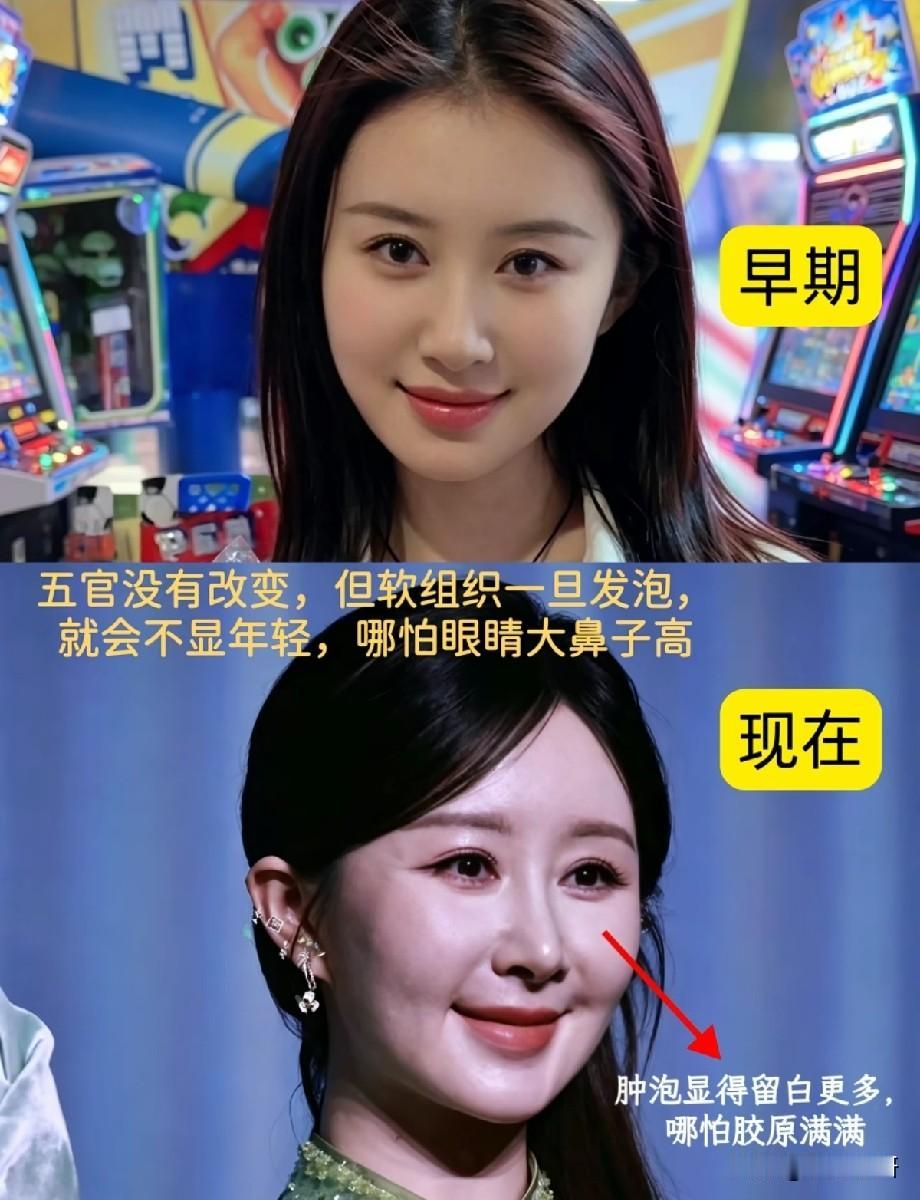 舒畅新旧照对比引热议！抗衰不是一味填充，软组织管理才是关键
 
近日，一组舒畅早