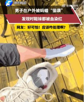 吓出一身冷汗！云南，一名户外大哥进山徒步全程没察觉半点疼痛，中途坐下休息脱鞋透气
