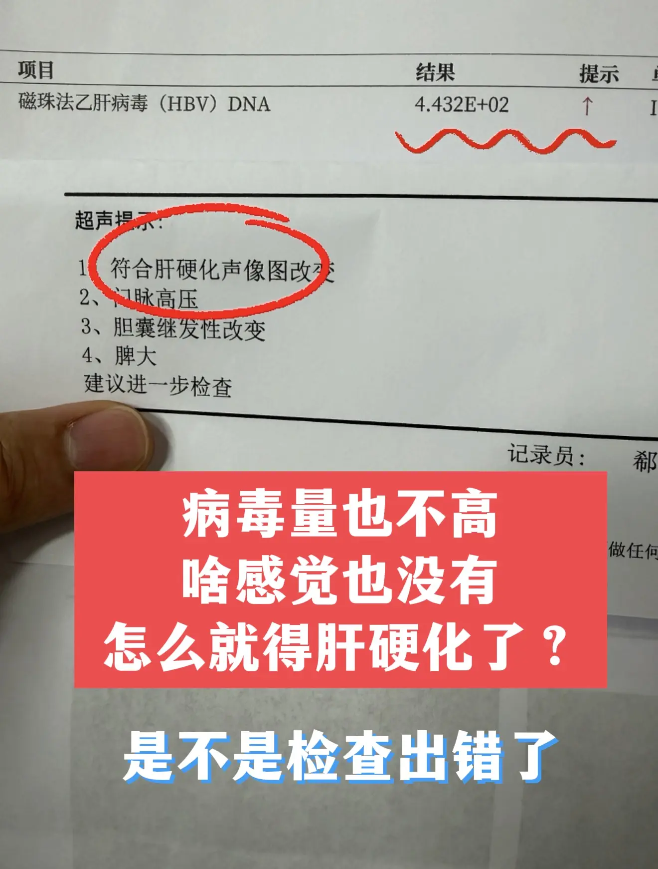 从河南专程来的乙肝患者，拿着在当地检查的化验单找到我说，病毒量也不是很...