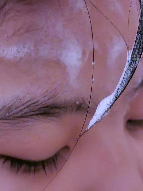 脸部白癜风会造成哪些危害呢?亅