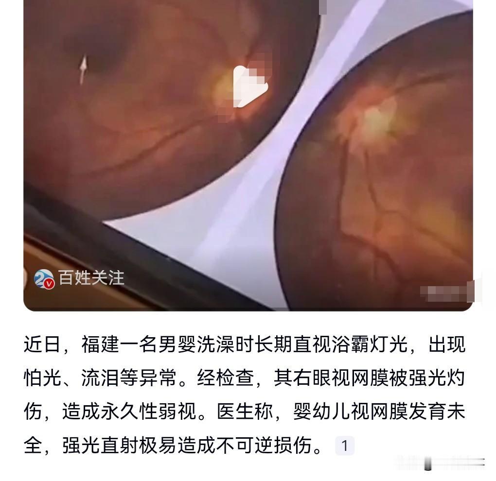 这真是太悲剧了，竟然发生这样的事情。

近日，6个月大男婴洗澡，家长怕冷着孩子，