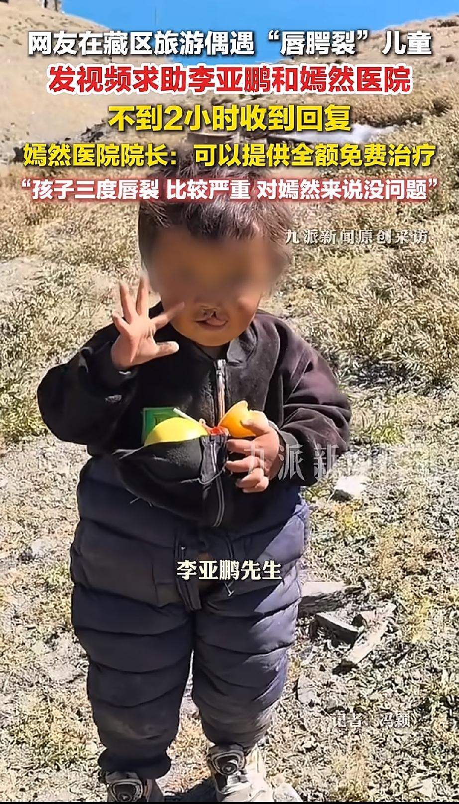 太感人了，
在藏区旅游的一位网友，无意间遇到一位唇腭裂孩子。拍了视频在网上喊话李