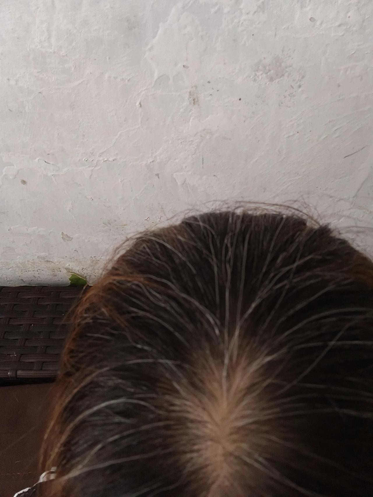 我妈妈今年七十三了，头发还是乌黑发亮，头上白头发也是非常少，七十岁之前一根白发都