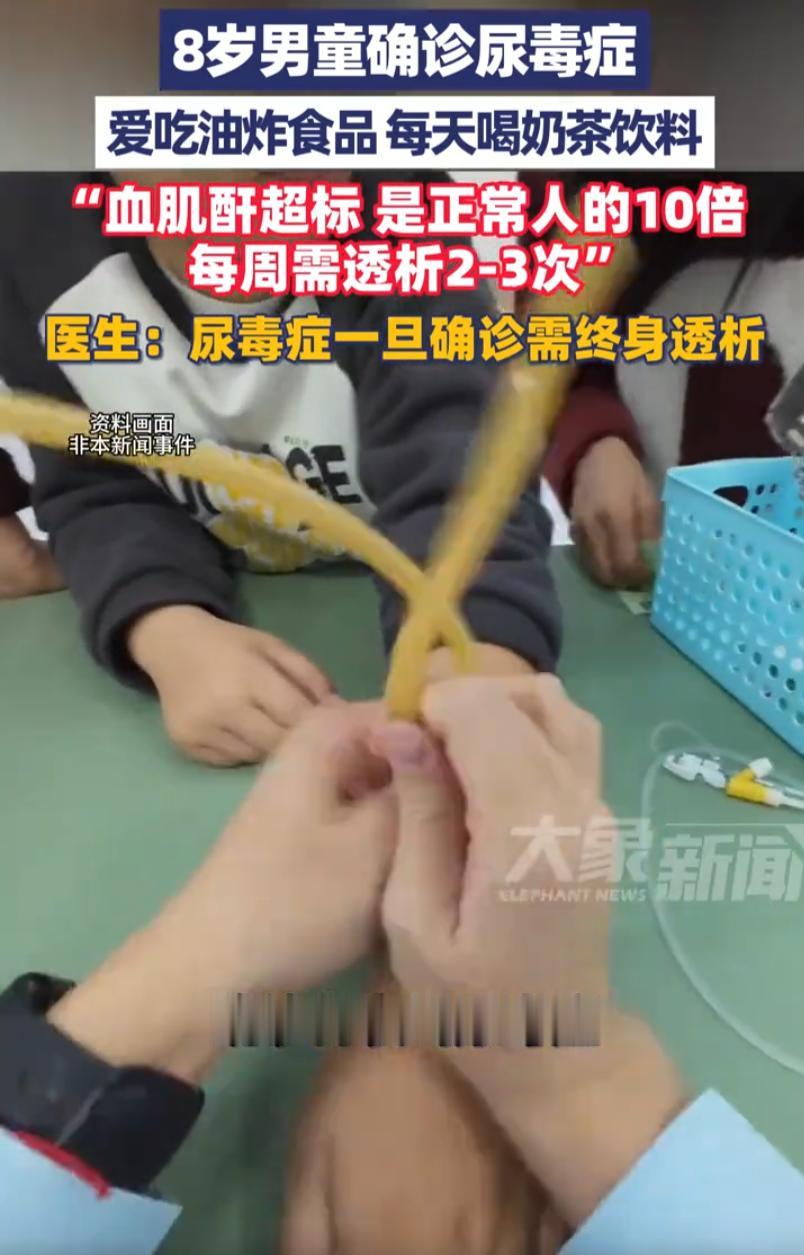 才8岁的孩子，硬生生喝出、吃出来尿毒症！河南郑州，一八岁男孩顿顿馋炸鸡、薯条这类