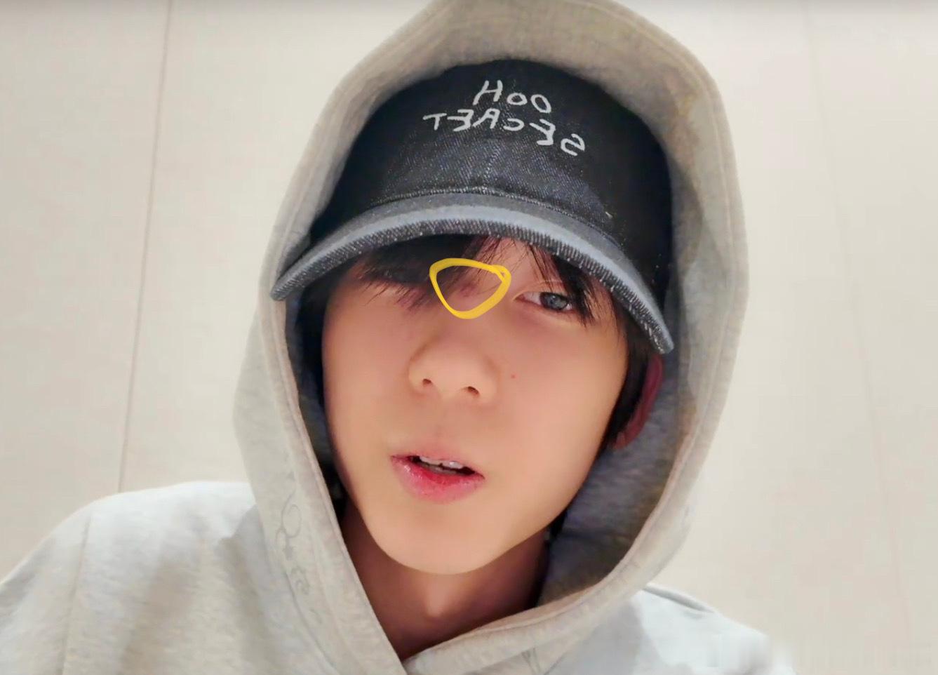 tg 杨博文这里是咋了 ​​​