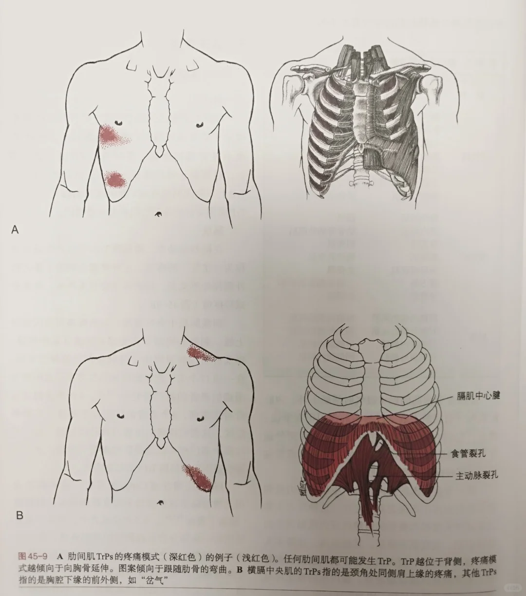 肋间肌和膈肌的疼T模式