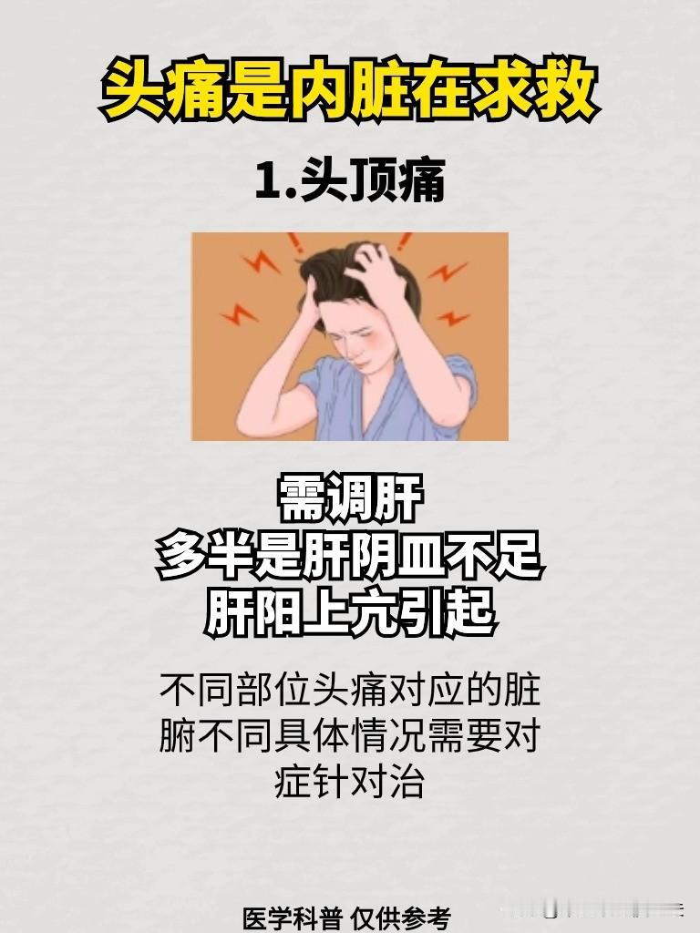 头痛是内脏在求救！#健康养生##中医##头痛#
1、头顶痛——需调肝，多半是肝阴