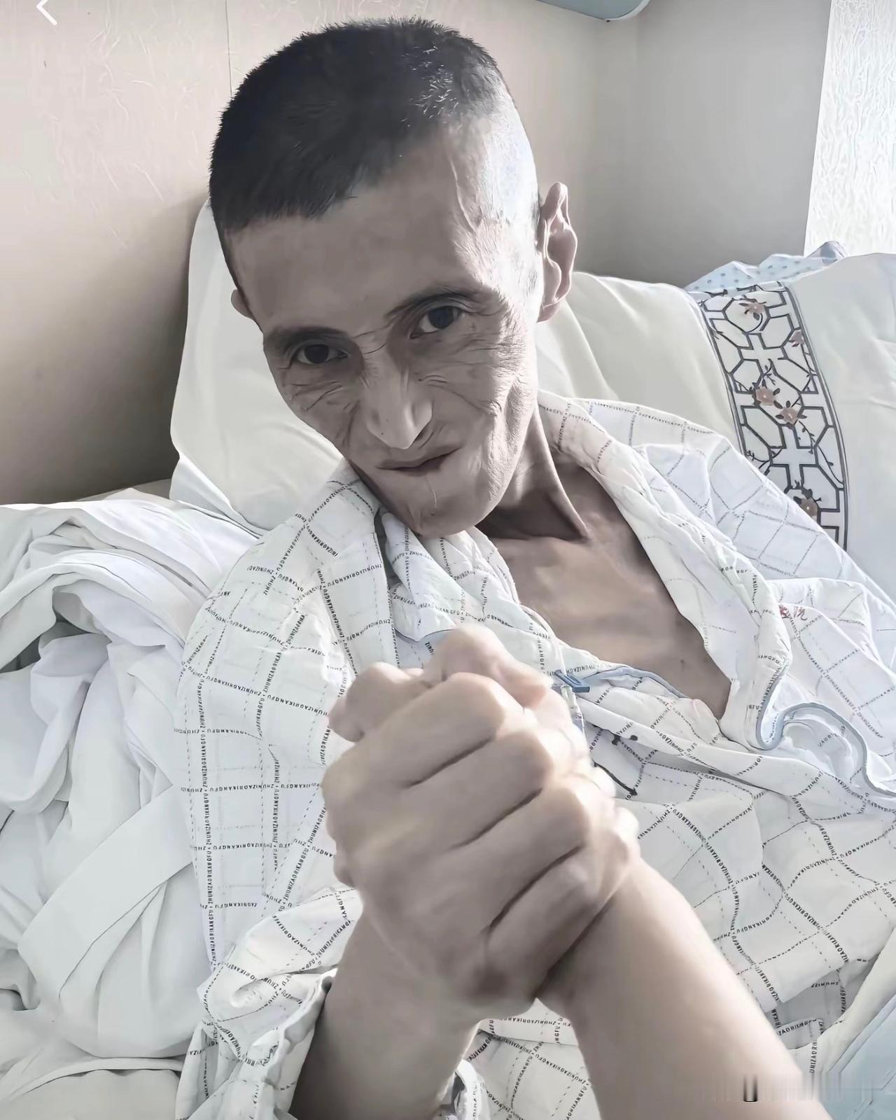 电焊工江小鱼走了，他最后一句话是：
“抱歉我已尽力了，阵地没守住！”
食道癌让他