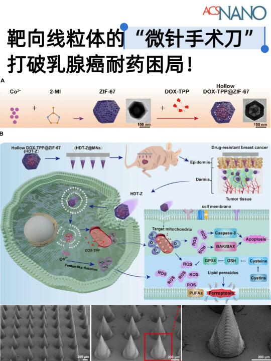 线粒体靶向微针系统，打破阿霉素耐药困局