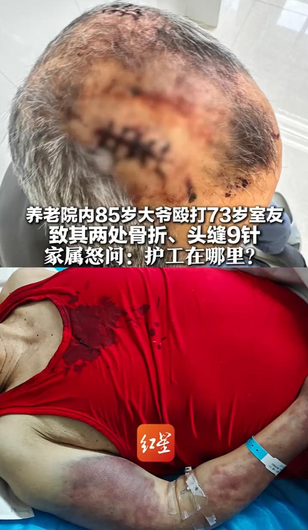 简直令人发指！内蒙古赤峰，一位73岁老人，在收费不菲的养老院里，被同住的85岁老