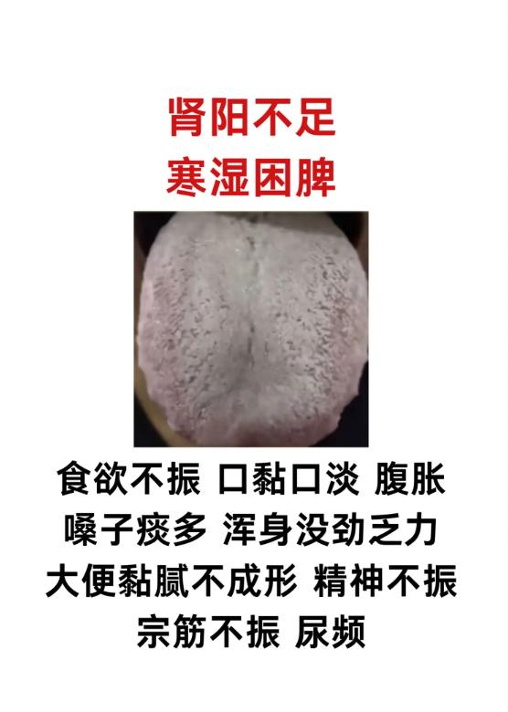 肾阳不足的 3 种舌象，寒湿重的不同表现