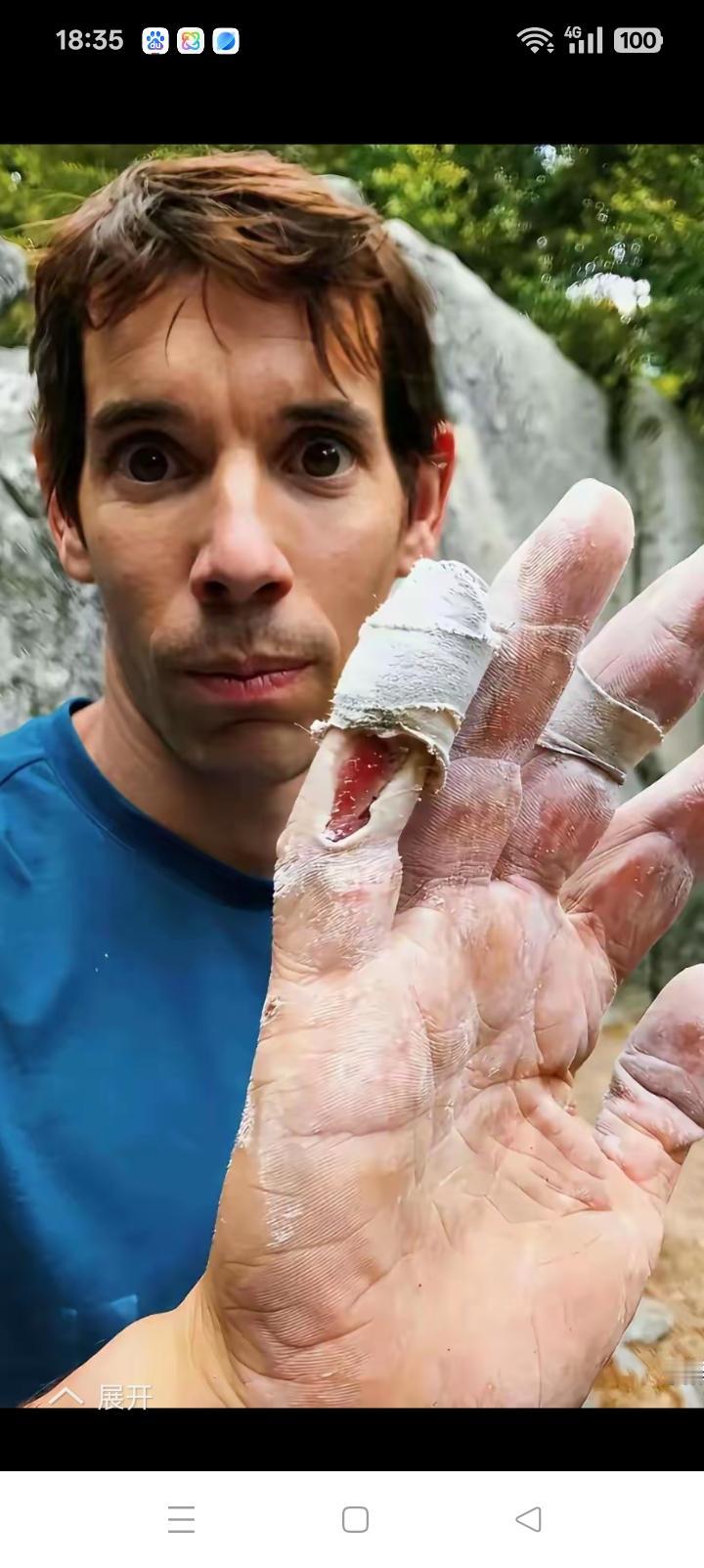 一个半小时赚1000万台币，看看艾力克斯的手你就知道不仅仅是玩命。
天赋很重要，