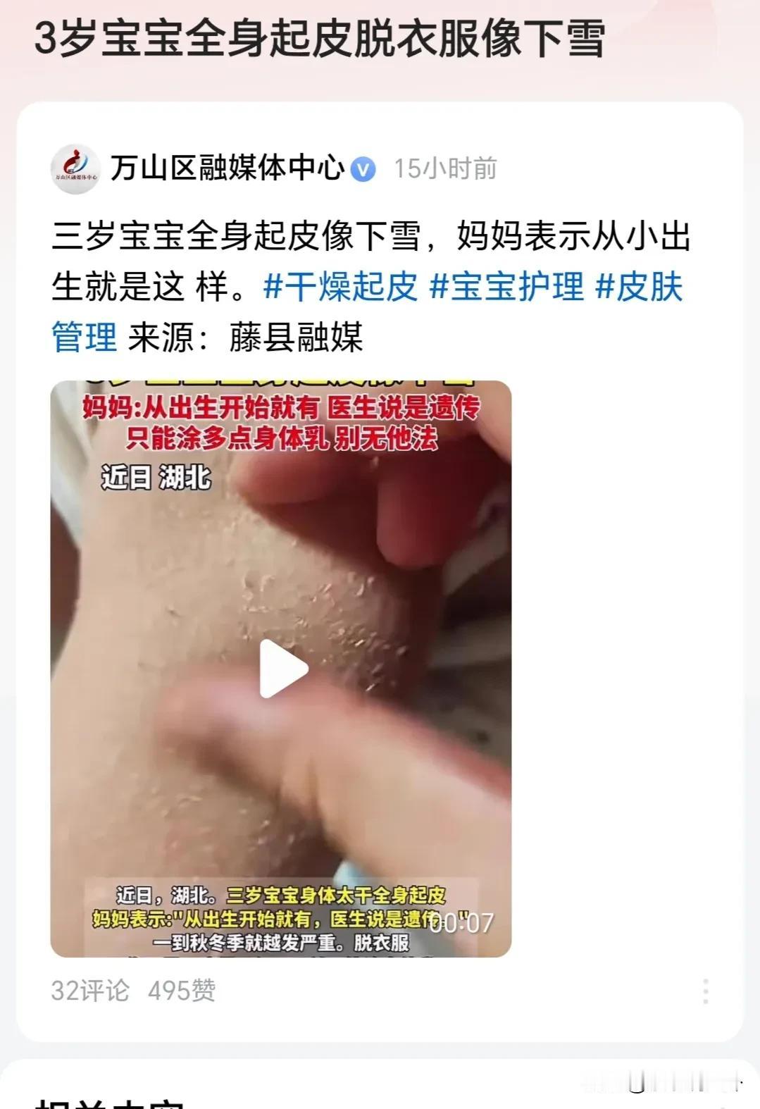 这个小宝宝皮肤病好严重。有点可怜